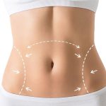 Understanding the Basics of Tummy Tuck Procedures in Washington DC